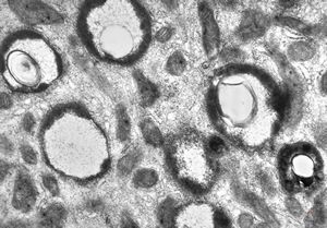 jejunum … unclassified vacuoles in enterocytes jejunum … unclassified vacuoles in enterocytes